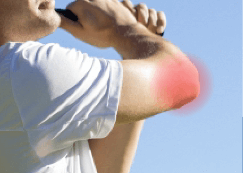 テニス肘・ゴルフ肘 野球肩・野球肘